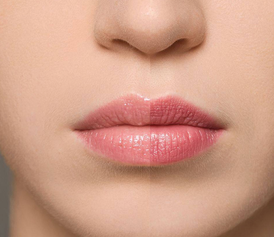 Supreme Lip Treatment – Fraise