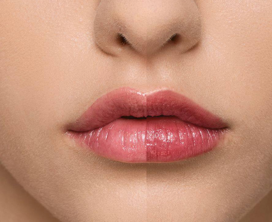 Supreme Lip Treatment – Framboise